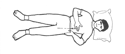 要旨：直推左橫腹筋。 做法：以左手在左邊軟協下腰腎處，大指向前，四指托後，輕輕捏定，用右手中三指，自左乳下直推至腿夾止，二十一次。 